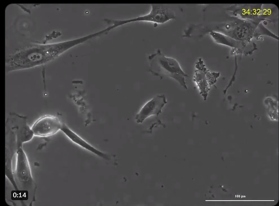 Neil Riordan, PhD, Shows Video of Dividing UCB-Derived MSCs