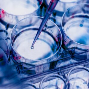 scientist pipetting a sample into a multi-well plate during an experiment in a lab