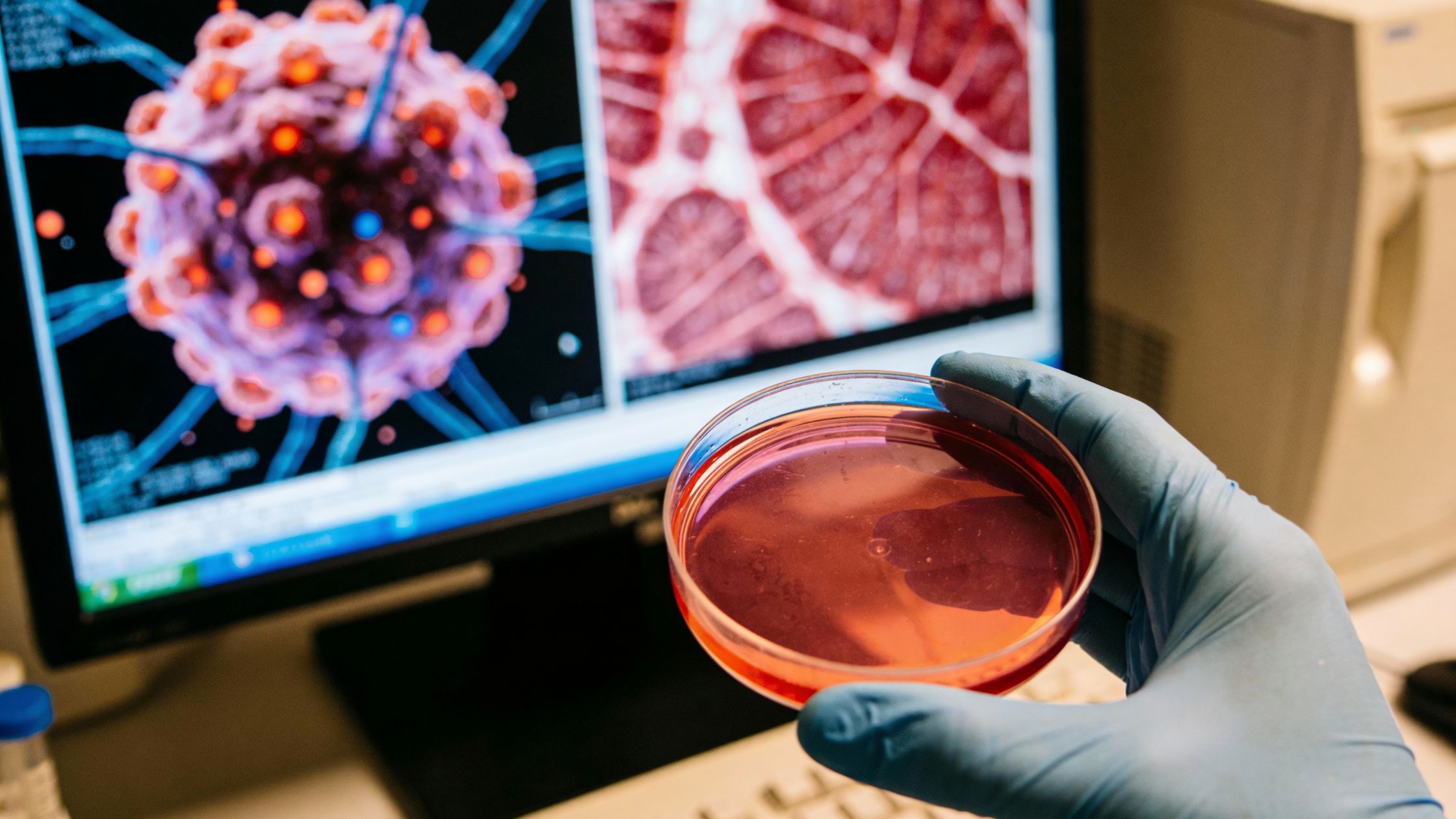 Mesenchymal Stem Cells: Does Source Matter?